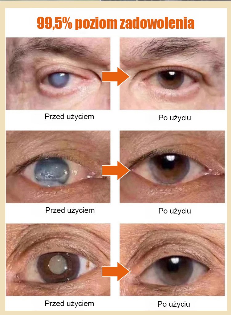 LANISKA krople do oczu z miodem do pielęgnacji oczu