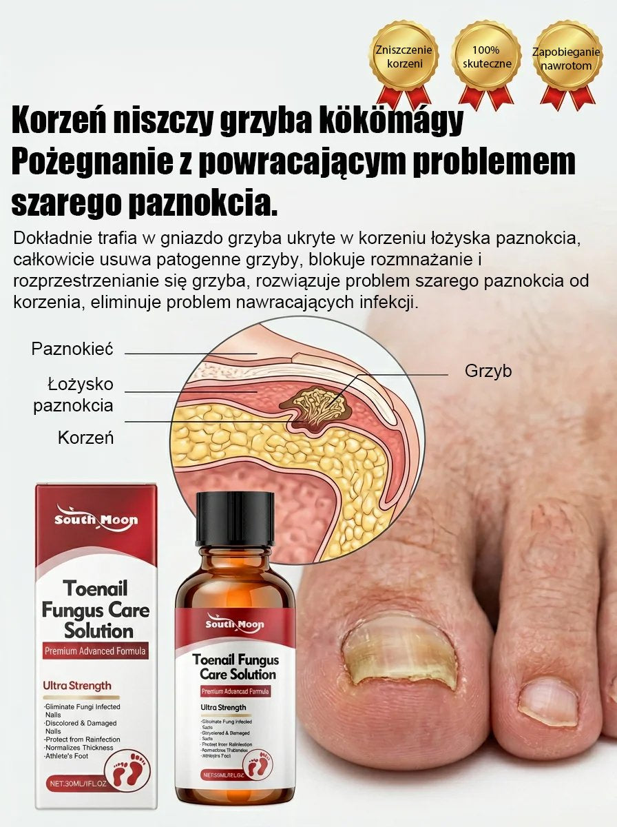 【Bezbolesna wymiana paznokci】Ziołowy łagodny płyn do naprawy paznokci dotkniętych grzybicą