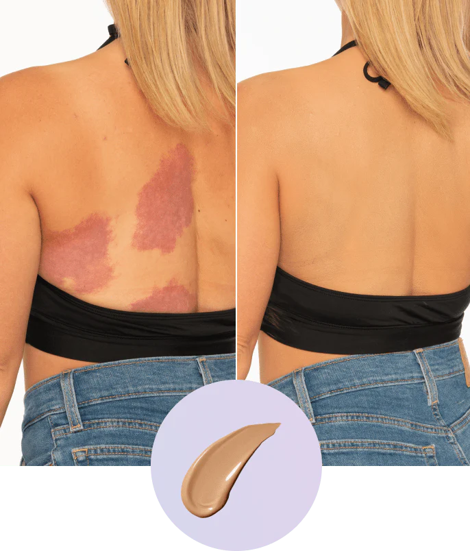 💜Последен ден – купете 1, вземете 1 безплатно!💜✨Body Perfector – водоустойчив, лек и безупречен грим за тяло